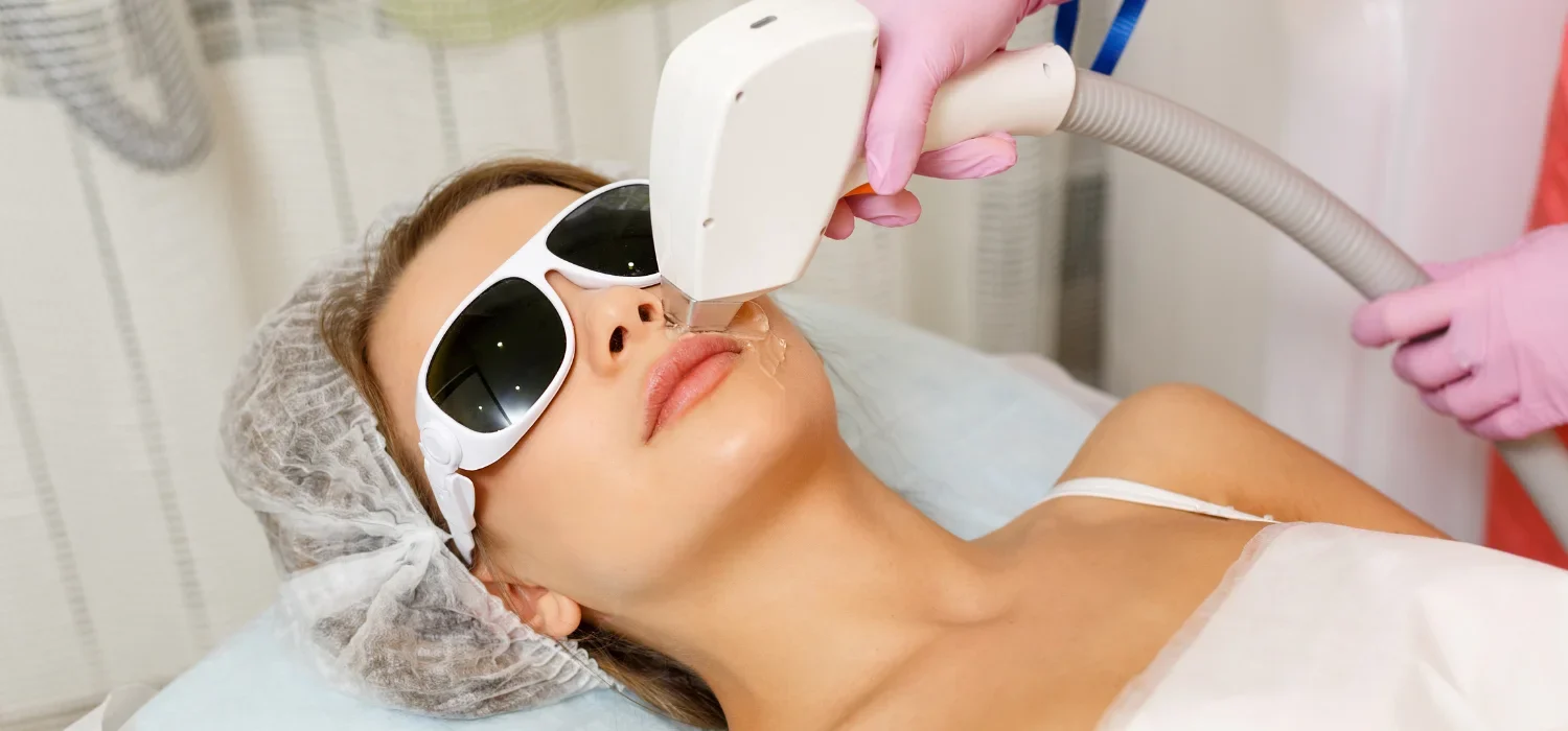 IPL Laser Newport Beach