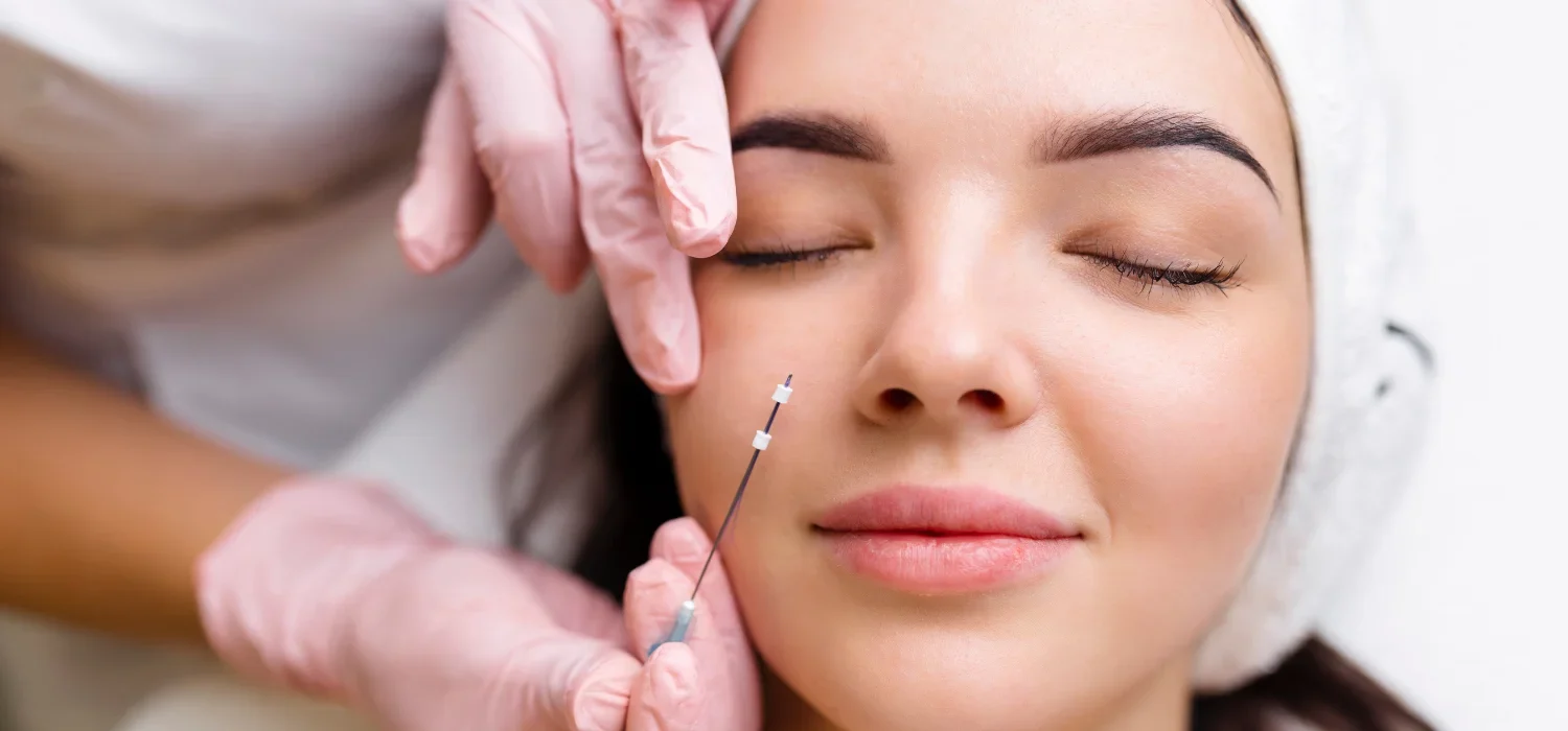 Facelift in Newport Beach