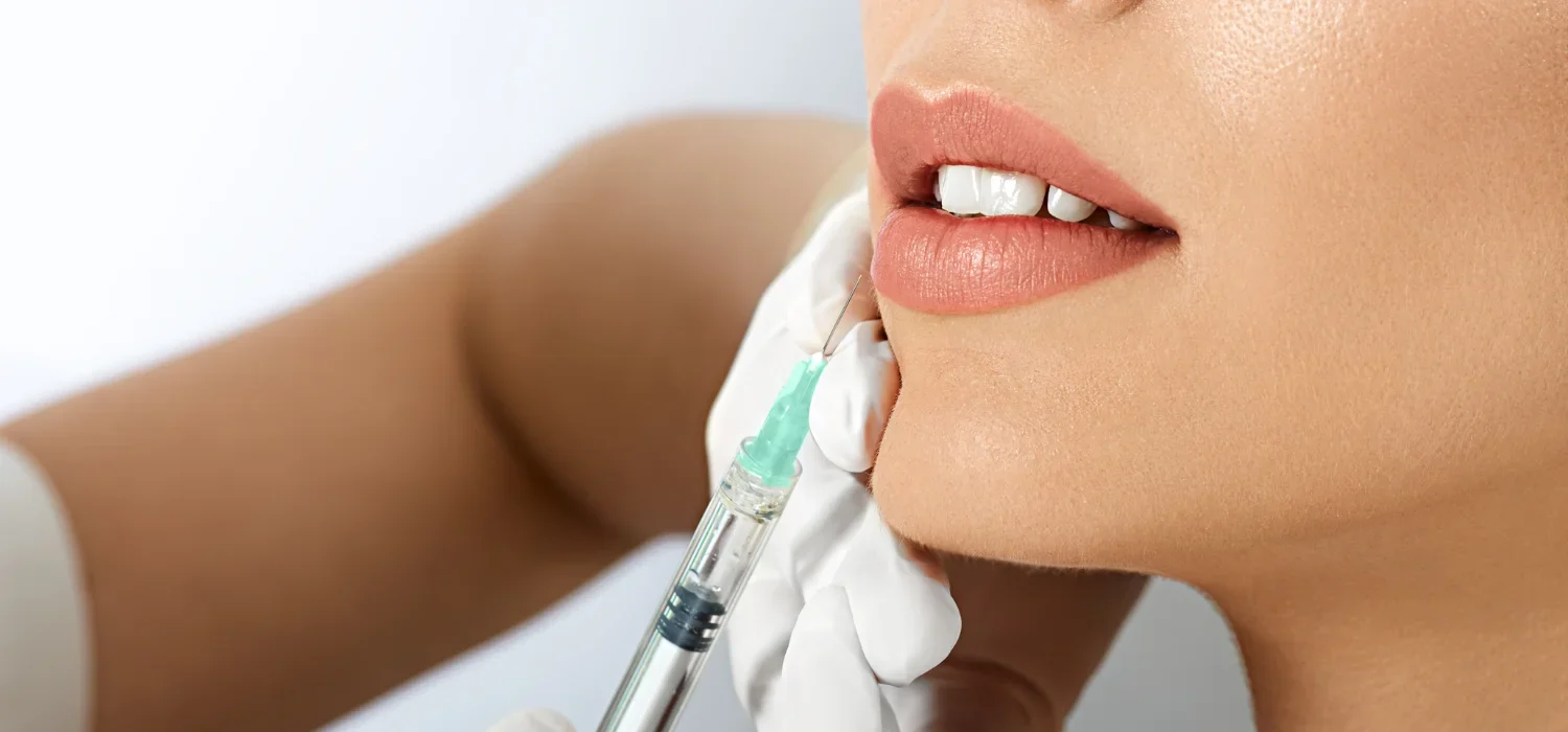 Lip Augmentation in Newport Beach