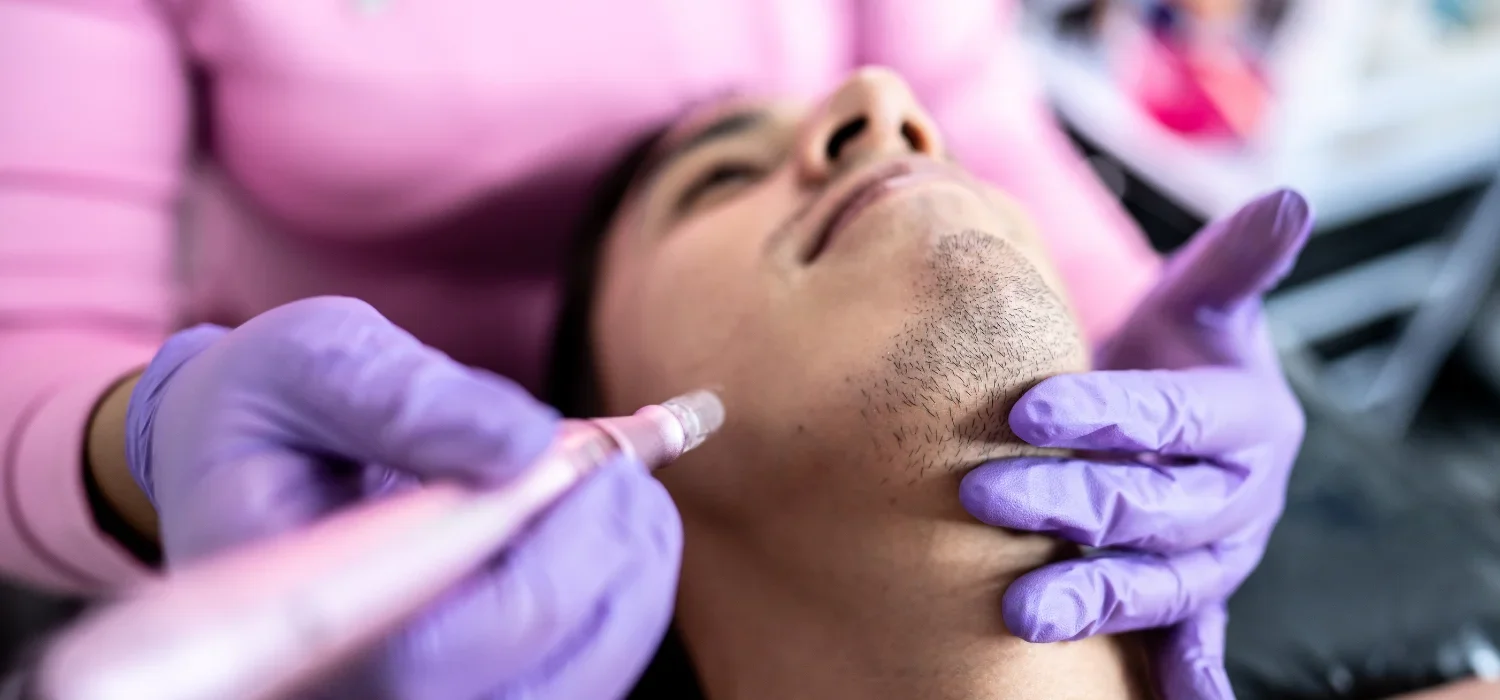 Microneedling Newport Beach