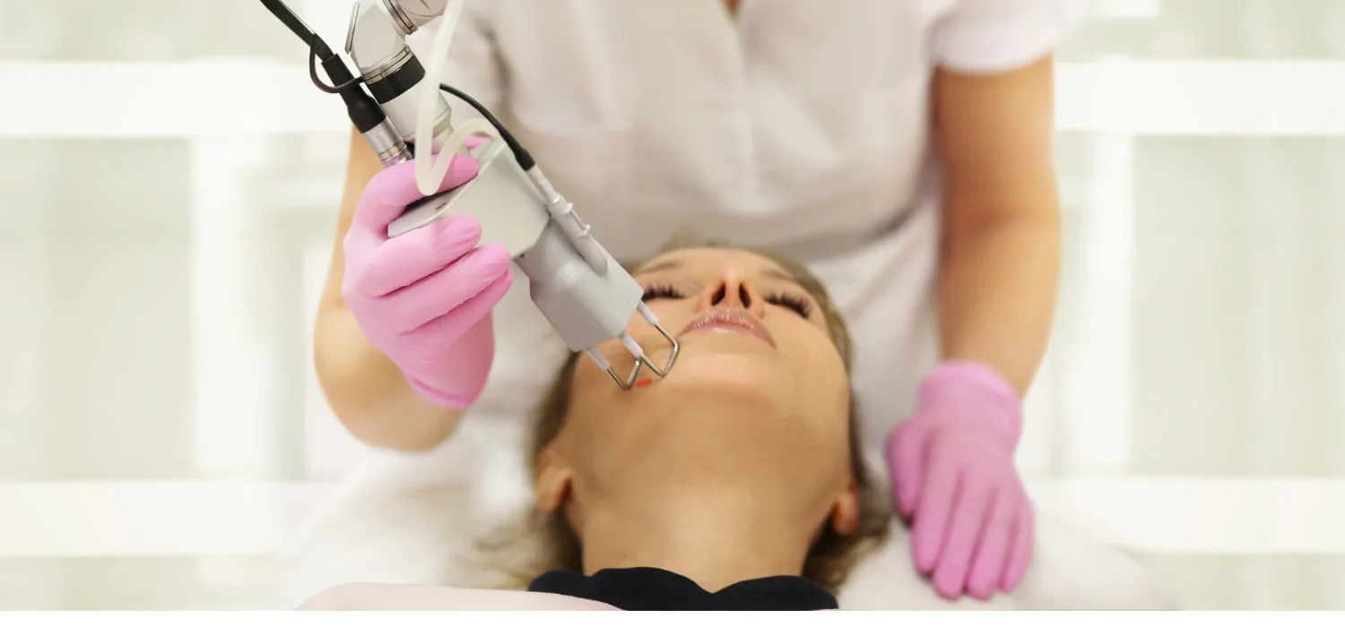 IPL Laser Newport Beach