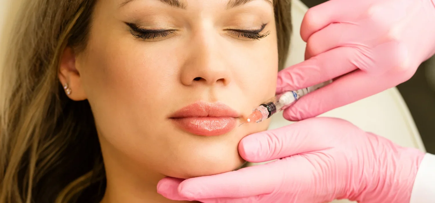 Lip Fillers Newport Beach