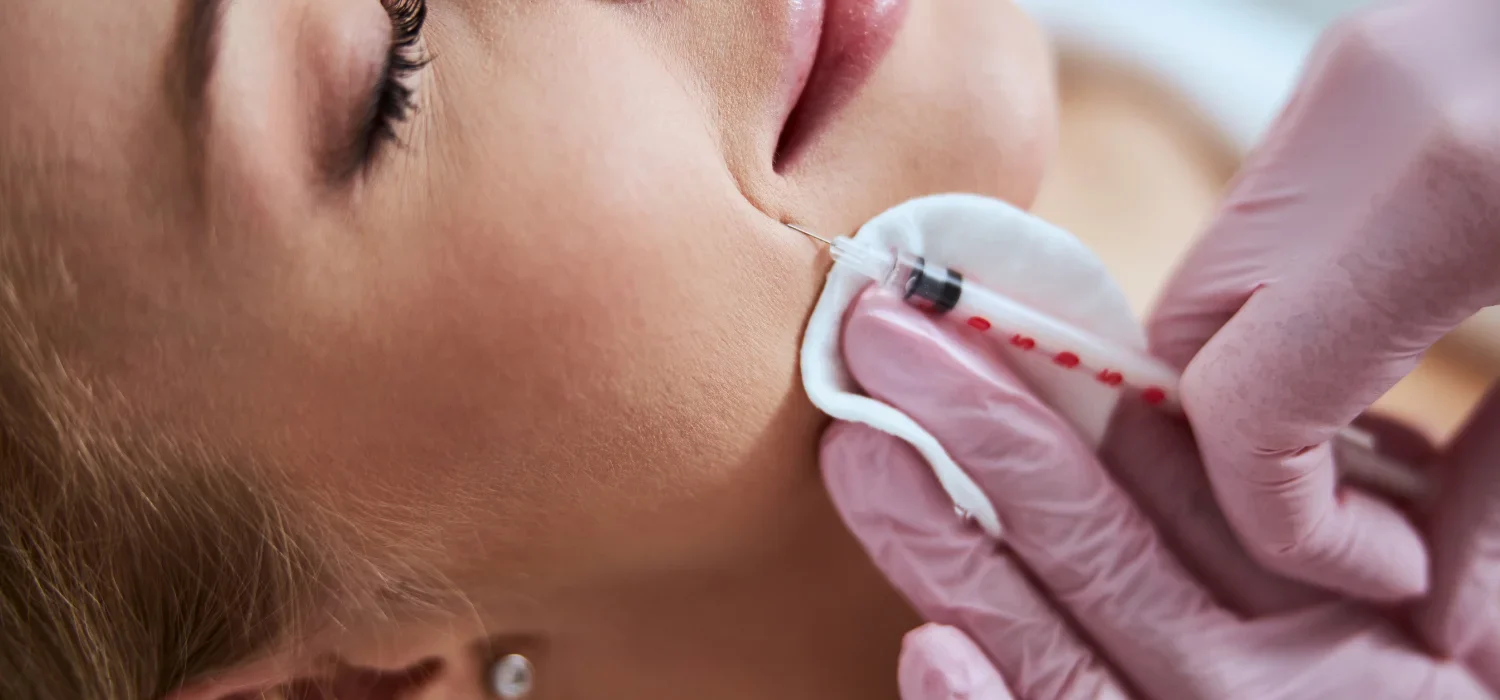 Restylane Refyne Newport Beach